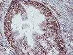 MCAK Antibody in Immunohistochemistry (Paraffin) (IHC (P))
