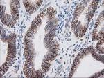 IRF6 Antibody in Immunohistochemistry (Paraffin) (IHC (P))