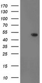 DOK2 Monoclonal Antibody (OTI2D10)