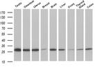 PGAM2 Antibody in Western Blot (WB)