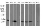 PGAM2 Antibody in Western Blot (WB)