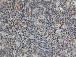 FDFT1 Antibody in Immunohistochemistry (Paraffin) (IHC (P))