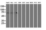 MTFMT Antibody in Western Blot (WB)