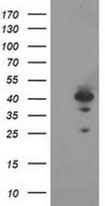 RAD51B Antibody in Western Blot (WB)