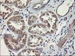 MTFMT Antibody in Immunohistochemistry (Paraffin) (IHC (P))