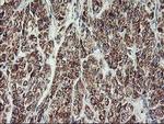 MTFMT Antibody in Immunohistochemistry (Paraffin) (IHC (P))