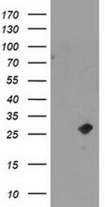 CDKN3 Antibody in Western Blot (WB)