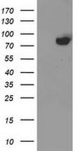 ACSS2 Antibody in Western Blot (WB)