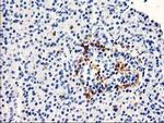 TP73-AS1 Antibody in Immunohistochemistry (Paraffin) (IHC (P))