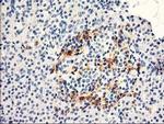 TP73-AS1 Antibody in Immunohistochemistry (Paraffin) (IHC (P))