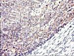 CYP2J2 Antibody in Immunohistochemistry (Paraffin) (IHC (P))