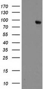 DPP10 Antibody in Western Blot (WB)