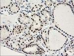 PRMT2 Antibody in Immunohistochemistry (Paraffin) (IHC (P))