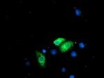 Ribophorin I Antibody in Immunocytochemistry (ICC/IF)