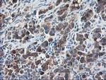 Ribophorin I Antibody in Immunohistochemistry (Paraffin) (IHC (P))