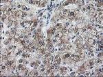 Ribophorin I Antibody in Immunohistochemistry (Paraffin) (IHC (P))