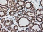 Ribophorin I Antibody in Immunohistochemistry (Paraffin) (IHC (P))