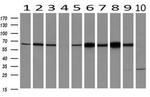 Ribophorin I Antibody in Western Blot (WB)