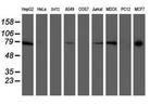 Ribophorin I Antibody in Western Blot (WB)