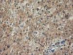 ALS2CR1 Antibody in Immunohistochemistry (Paraffin) (IHC (P))