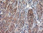 Calpain 9 Antibody in Immunohistochemistry (Paraffin) (IHC (P))