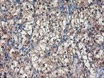 ALS2CR1 Antibody in Immunohistochemistry (Paraffin) (IHC (P))
