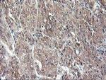 ALS2CR1 Antibody in Immunohistochemistry (Paraffin) (IHC (P))