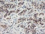 ALS2CR1 Antibody in Immunohistochemistry (Paraffin) (IHC (P))
