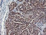 ALS2CR1 Antibody in Immunohistochemistry (Paraffin) (IHC (P))