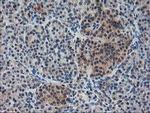 ALS2CR1 Antibody in Immunohistochemistry (Paraffin) (IHC (P))
