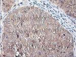 ALS2CR1 Antibody in Immunohistochemistry (Paraffin) (IHC (P))