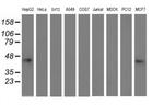 ALS2CR1 Antibody in Western Blot (WB)