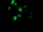 AIPL1 Monoclonal Antibody (OTI3B4)