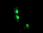 AIPL1 Monoclonal Antibody (OTI2B11)