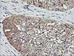 ASCC1 Antibody in Immunohistochemistry (Paraffin) (IHC (P))