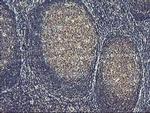 ASCC1 Antibody in Immunohistochemistry (Paraffin) (IHC (P))