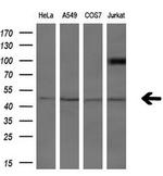 ASCC1 Antibody in Western Blot (WB)