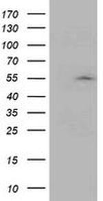 ASCC1 Antibody in Western Blot (WB)