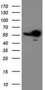 RbAp46 Antibody in Western Blot (WB)