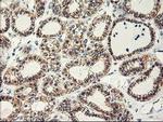APBB3 Antibody in Immunohistochemistry (Paraffin) (IHC (P))