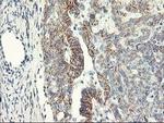 APBB3 Antibody in Immunohistochemistry (Paraffin) (IHC (P))