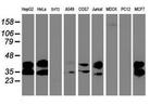 UNG Antibody in Western Blot (WB)