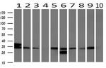 UNG Antibody in Western Blot (WB)