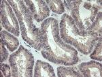 KRTAP2-4 Antibody in Immunohistochemistry (Paraffin) (IHC (P))