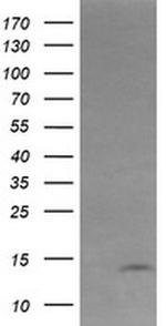 KRTAP2-4 Antibody in Western Blot (WB)
