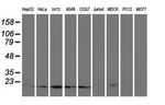 UBE2M Antibody in Western Blot (WB)