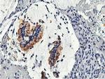 Calpain 9 Antibody in Immunohistochemistry (Paraffin) (IHC (P))