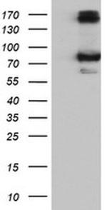 Calpain 9 Antibody in Western Blot (WB)