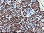 NUDT18 Antibody in Immunohistochemistry (Paraffin) (IHC (P))