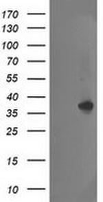 NUDT18 Antibody in Western Blot (WB)